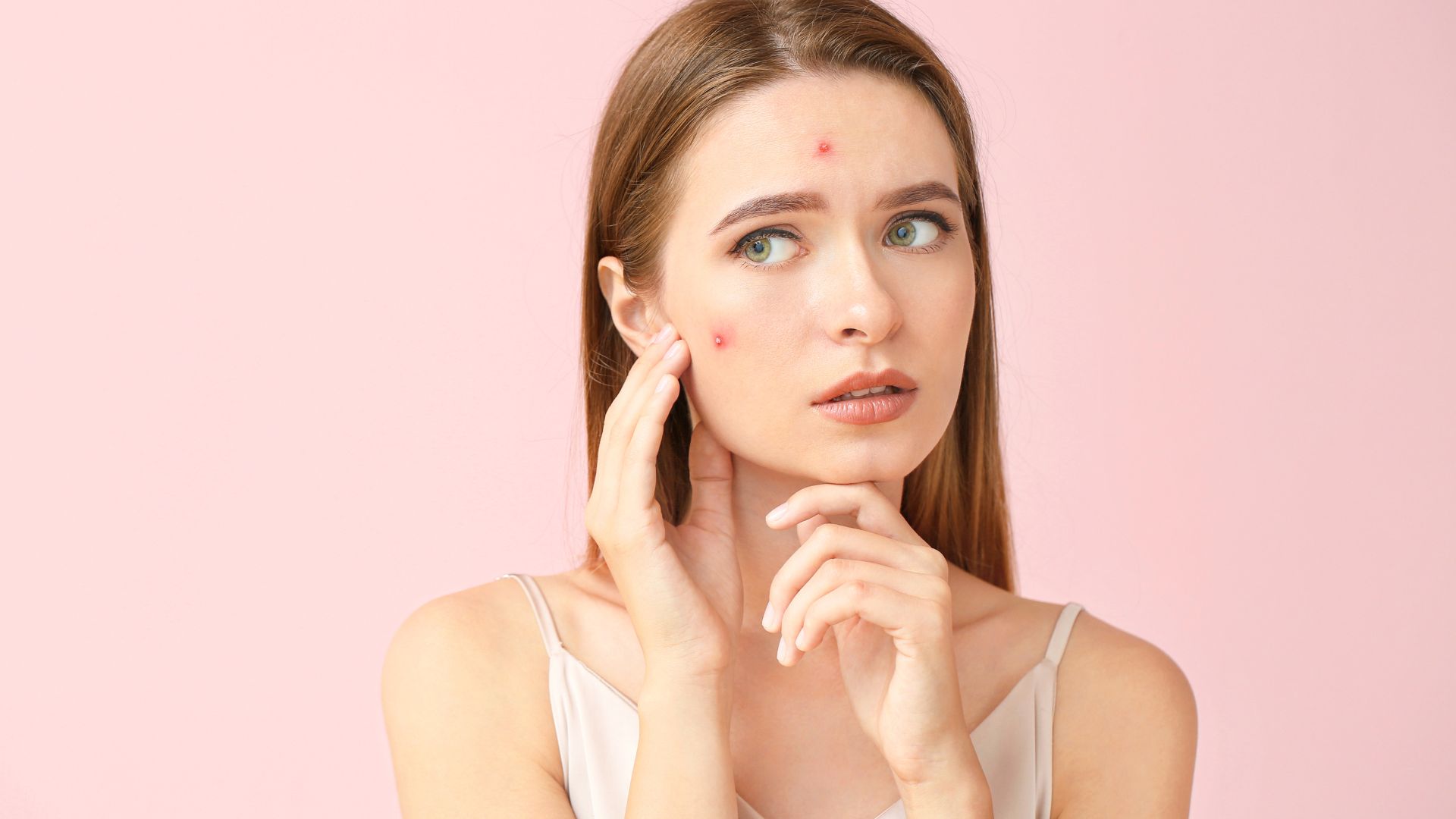 Acne Treatment in Dubai: Popular Choices for Teenagers and Adults