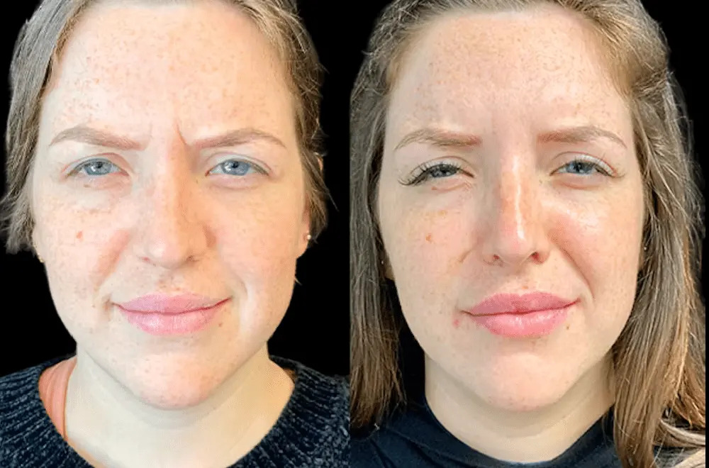 Why the Best Aesthetic Clinic in Dubai Is the Safest Choice for Botox Treatments