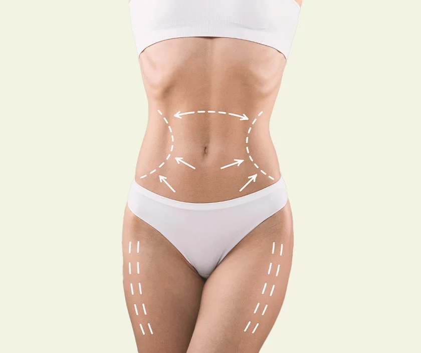 fat transfer in dubai