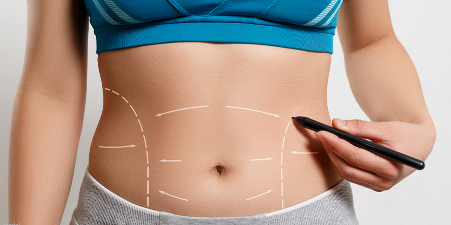 A Complete Guide to Abdominoplasty in Jeddah and Its Benefits