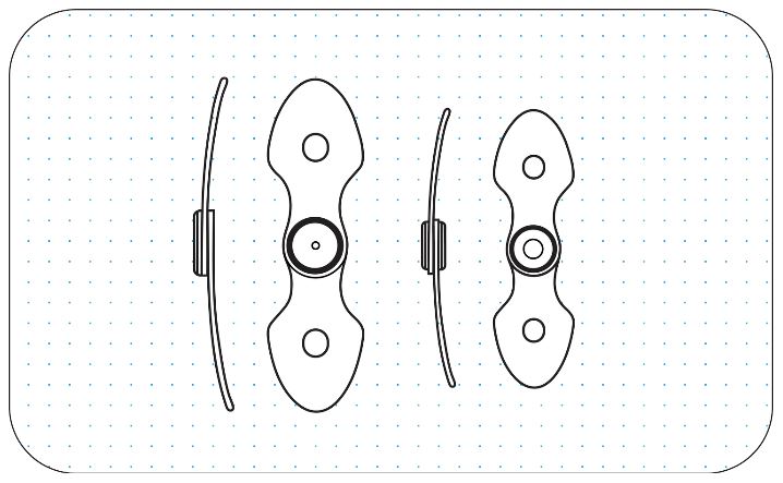 orthotic joint top-bottom alignment